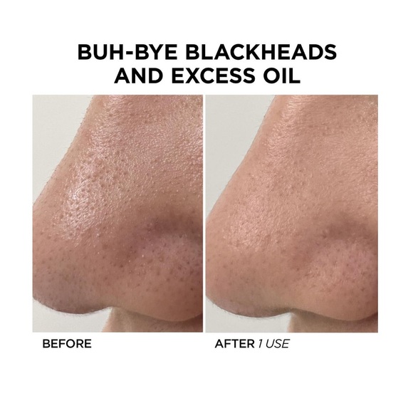 NWT BeautyBio GLOfacial Hydro-Infusion Pore Cleansing + Blue LED Clarifying Tool - Picture 2 of 10